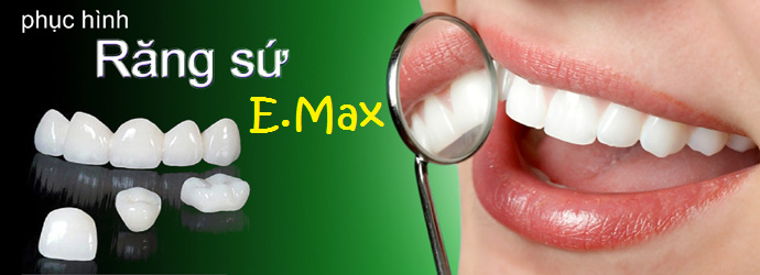 Bọc răng sứ thẩm mỹ để có hàm răng đẹp hoàn hảo