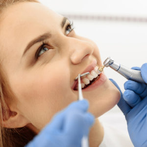 Các câu hỏi về tẩy trắng rằng phổ biến thường gặp