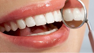 Các vấn đề thường gặp về chăm sóc răng miệng