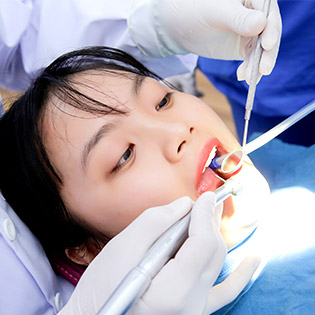 Có cần phải kiêng cữ sau khi cạo vôi răng
