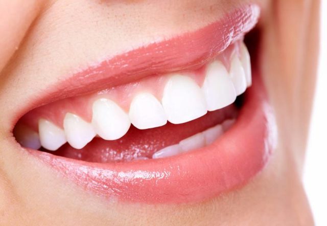 Điều bạn nên biết trước khi trám răng