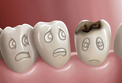 Làm thế nào điều trị răng chết