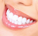 Những điều cần lưu ý sau khi cạo vôi răng