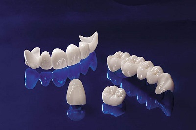 Tìm hiểu về các loại răng sứ  trên thị trường hiện nay