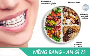 Xây Dựng Thực Đơn Ăn Uống Sau Khi Niềng Răng Chỉnh Nha
